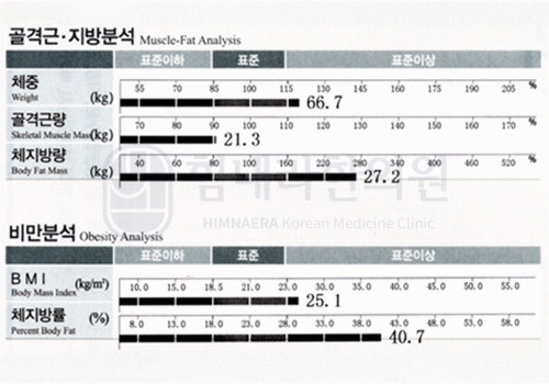After 이미지