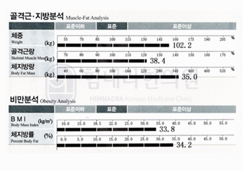 Before 이미지