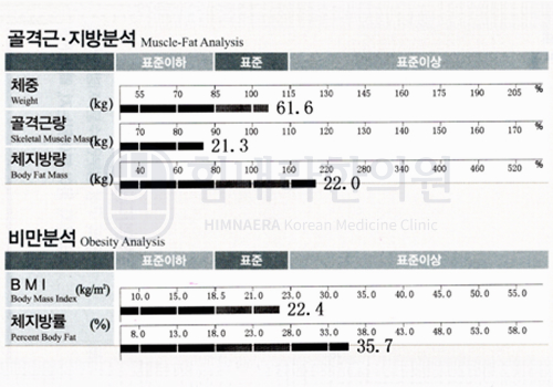 Before 이미지