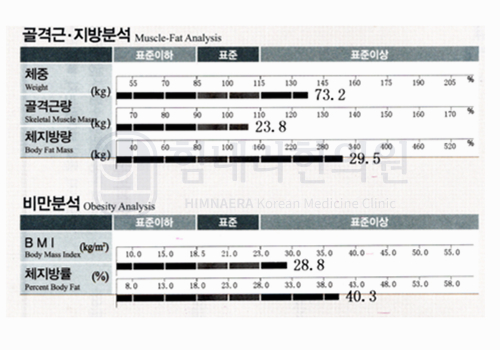 Before 이미지