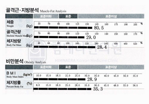 After 이미지