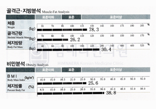 치료 전 이미지