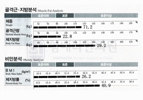 Before 이미지