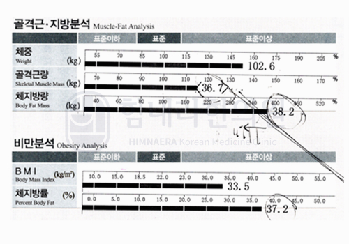 Before 이미지
