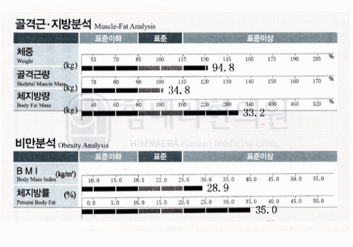 치료 전 이미지