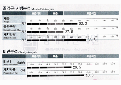 Before 이미지