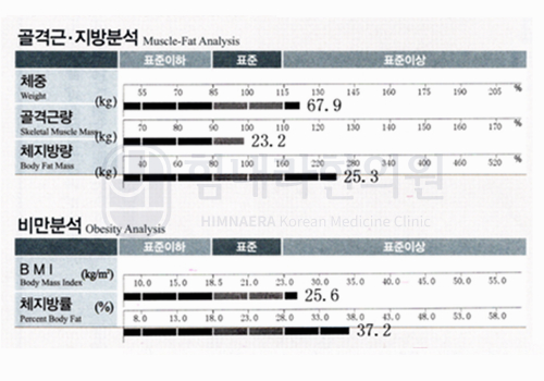 Before 이미지